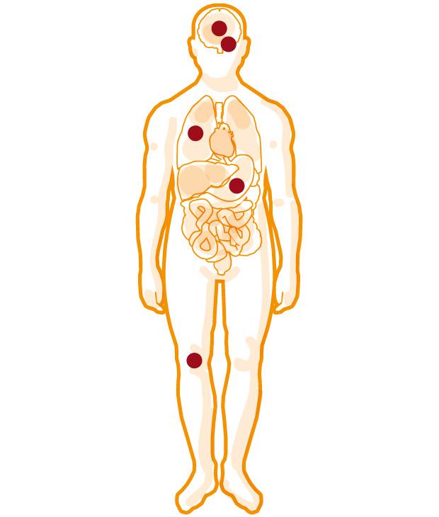 mapa, grafico, fluxograma…